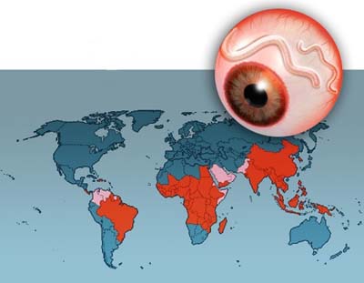 1246957788828_ocnchocercavolvulus3400-1