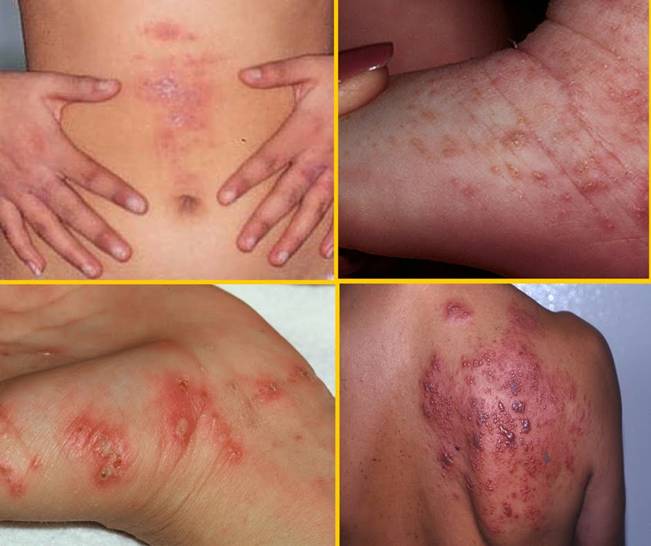 1487924060029_image008